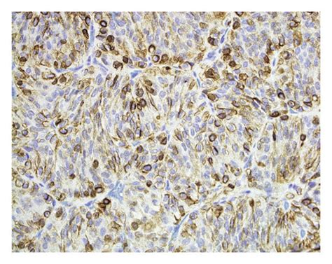 Strong Immunoreactivity In Principal Cells For Synaptophysin A