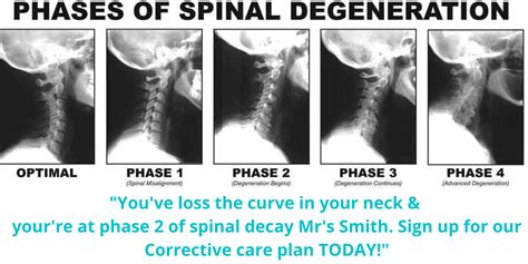 Why X Rays Are So Damaging Sydney Chiropractic And Massage