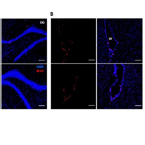 Ac Representative Confocal Photomicrographs Of Iba1 Green Gfap