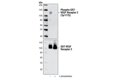 Vegf Receptor Control Proteins Cell Signaling Technology