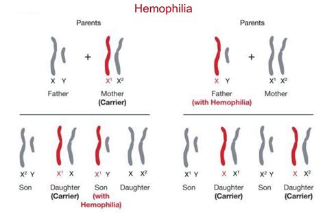 Sex Linked Traits And Disorders