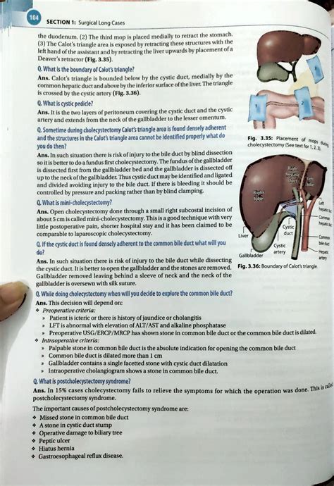 cholecystitis pdf.pdf