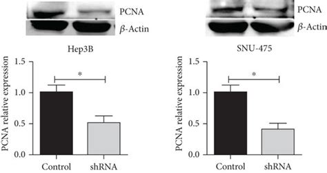 Interfering With KIF11 Inhibits The Proliferation Of Hep3B And SNU 475