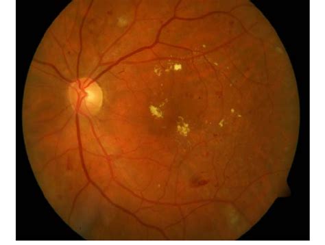 original retinal image  scientific diagram