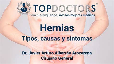 Sintomas De Hérnia Abdominal FDPLEARN