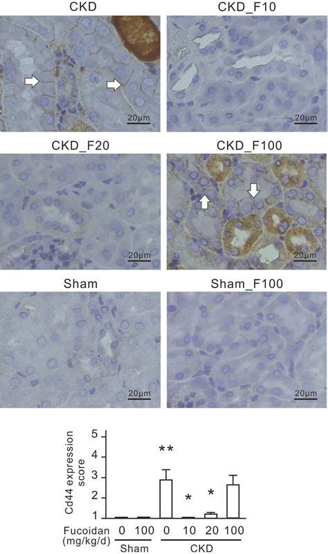 Oligo Fucoidan Reduces Cd Expression In Renal Tubular Cells In Ckd