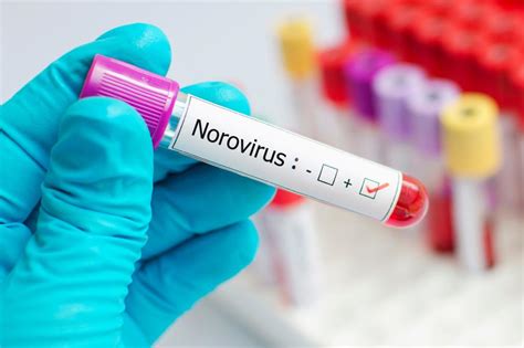 Norovirus confirmed after 50 college students fall ill in New York