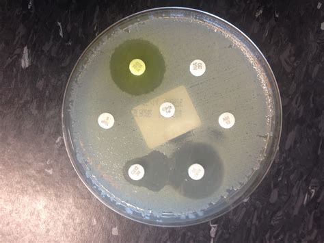 “disc Diffusion V Automated Susceptibility Testing” Microbiology Matters