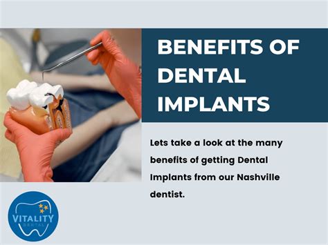 Ppt The Top Benefits Of Dental Implants You Didn T Know About