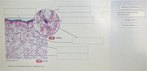 Solved Mucous connective tissue of umbilical cord | Chegg.com | Chegg.com