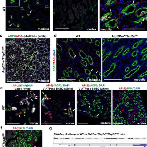 Ap And Ap Proteins Are Present In Distinct Distal Nephron