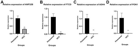 An Immune Subtype Related Prognostic Signature Of Hepatocellular