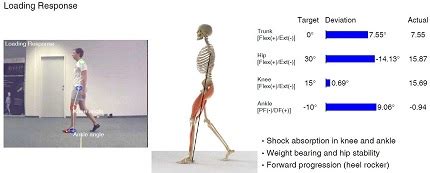 Clinical Gait Analysis