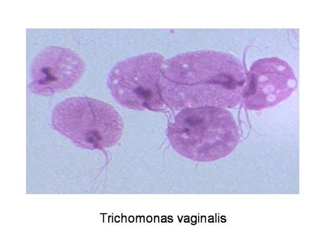 Vulvovaginitis