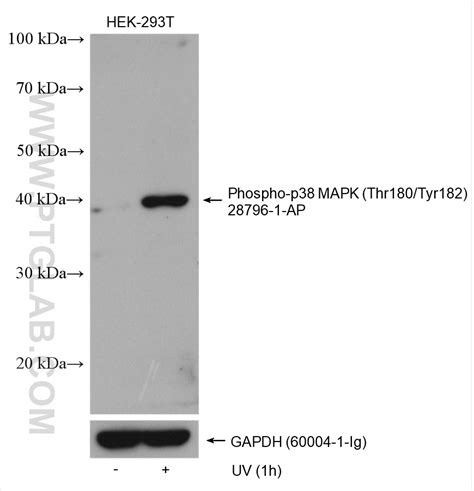 Phospho P Mapk Thr Tyr Antibody Ap Proteintech