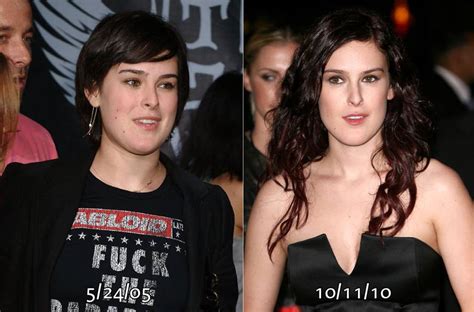 Searching for Perfection: Rumer Willis Before and After Plastic Surgery ...