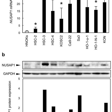 Evaluation Of Nusap1 Expression In Oscc Derived Cell Lines A