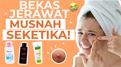 Manjur Skincare Hilangkan Bekas Jerawat Mulai Ribu Youtube