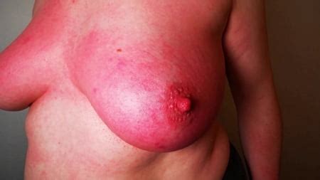 Hard Slapping Tits Real Red 39 Pics XHamster