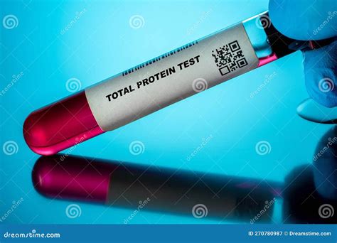 Total Protein Test Blood Tests for Older Adults. Recommended Blood Test ...