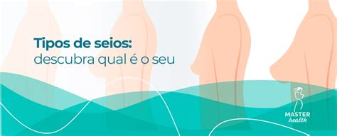 Tipos de seios descubra qual é o seu Blog Master Health