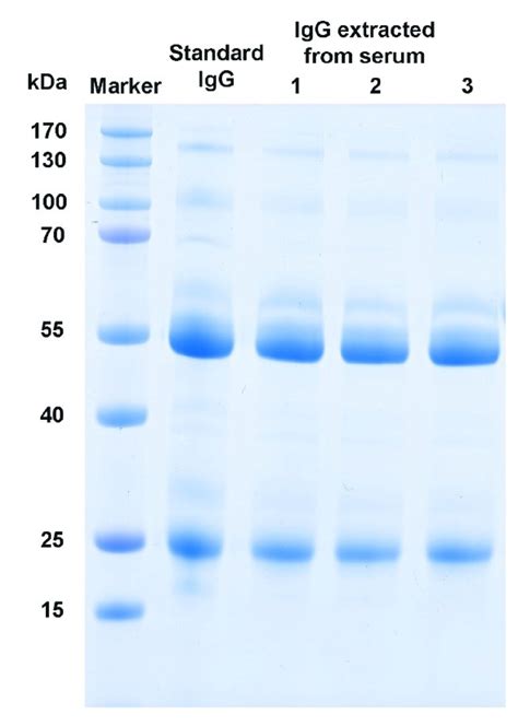 Fig S Sds Page Of Standard Igg And Igg Extracted From Human Serum