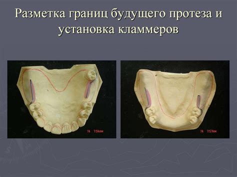 Изготовление проволочных кламмеров - презентация онлайн