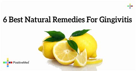 6 Best Natural Remedies For Gingivitis