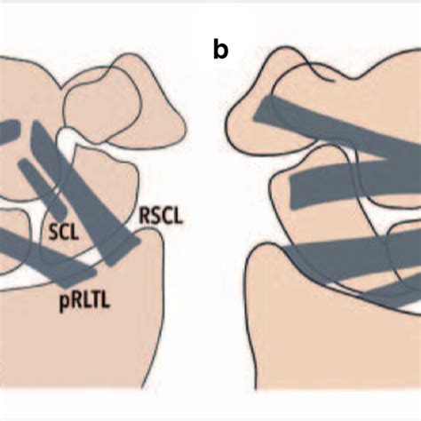 Proposed algorithm for scanning dorsal wrist ligaments. Licensee MDPI ...