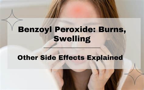 🔥 Benzoyl Peroxide: Burn, Swelling, Side Effects Explained