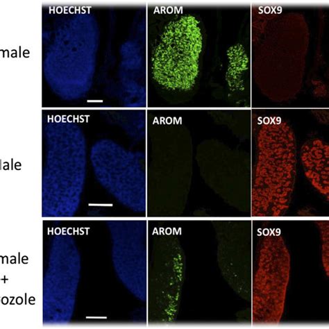 Effect Of Fadrozole On Expression Of Sex Specific Proteins In The Chick Download Scientific