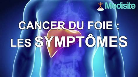 Cancer Du Foie Les Symptômes Vidéo Dailymotion