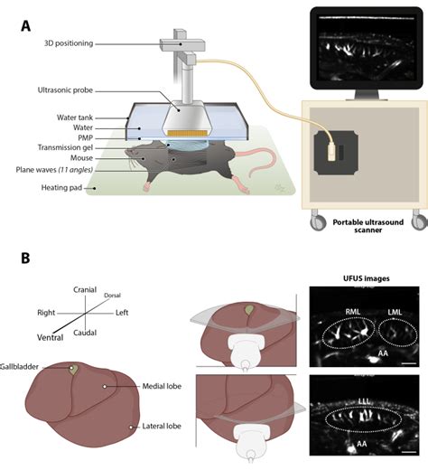 Imaging And Quantification Of The Hepatic Vasculature Of Mice Using