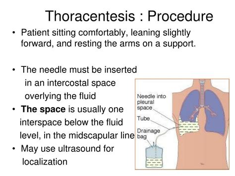 Ppt Pleural Disease Powerpoint Presentation Free Download Id5943695