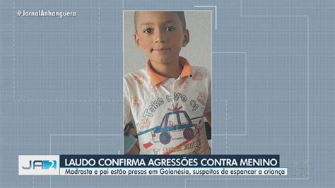 Madrasta Confessa Que Agrediu Menino Que Morreu Após Infecção Causada