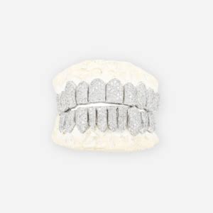 How Much Are Diamond Grillz? - RRP Diamond