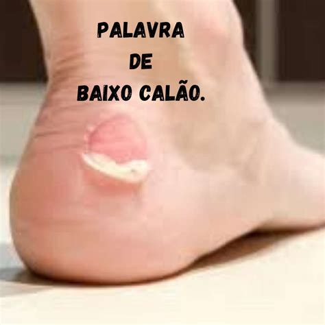 Qual O Correto Palavra De Baixo Calão Ou Escalão