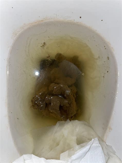 What’s going on here? Sometimes pain under rib area/where ribs meet