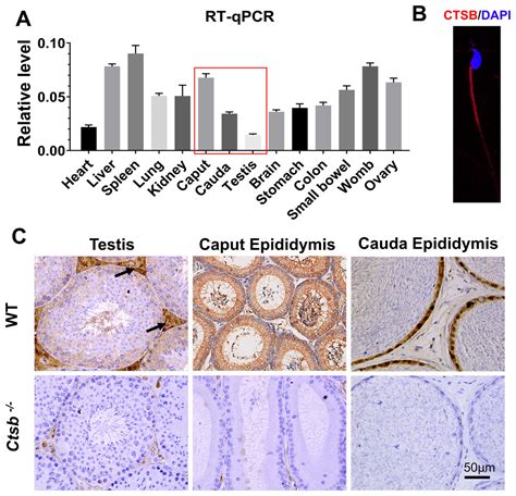 Cathepsin B Plays A Role In Spermatogenesis And Sperm Maturation