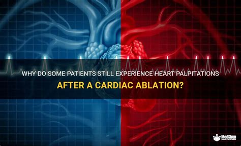 Why Do Some Patients Still Experience Heart Palpitations After A