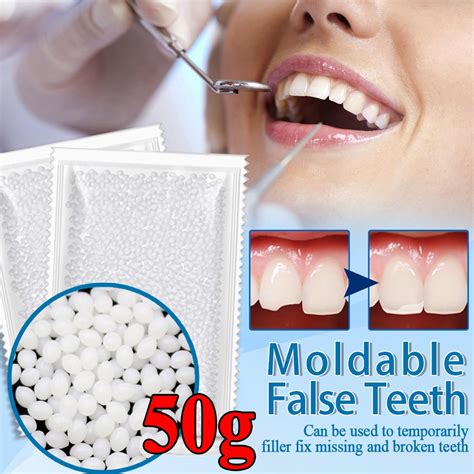 50g Temporary Tooth Repair Kit Teeth And Gaps Moldable Falseteeth Solid