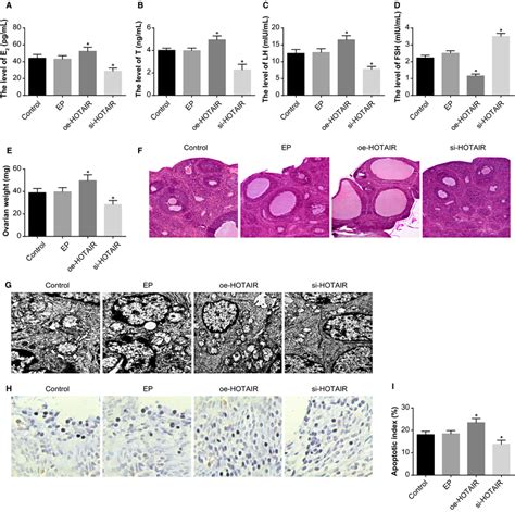 The Effect Of HOTAIR On The Endocrine And Ovarian Granulosa Cells In