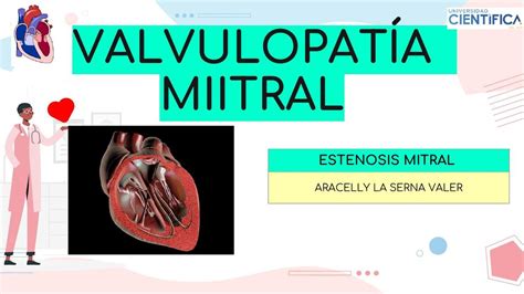 Res Menes De Estenosis Mitral Descarga Apuntes De Estenosis Mitral