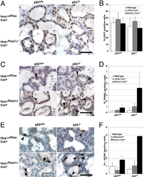 Increased Retention Of Hus1 Null Cells In Mammary Glands From