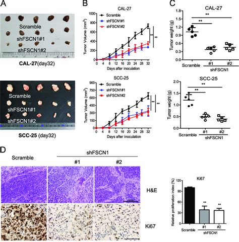 Knockdown Of Fscn Impaired Tumor Growth In A Xenograft Mouse Model A