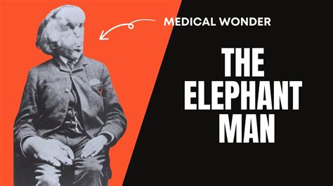 The Tragic Story Of Joseph Merrick The Elephant Man Youtube