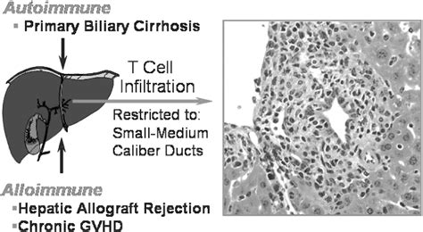 Figure 1 From The Role Of Biliary Epithelial Cells In The