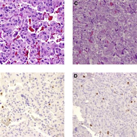 Representative histologic images. Hematoxylin and eosin stain (A and C)... | Download Scientific ...