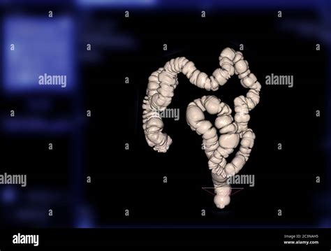 Ct Colonography Or Ct Scan Of Colon D Rendering Image Ap View Showing