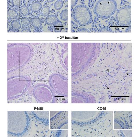 Histology of the epididymis. The caput, corpus, and cauda epididymides... | Download Scientific ...